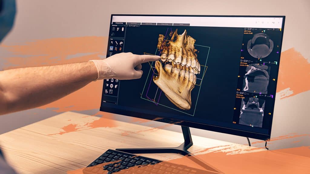 Digitale transformatie in de gezondheidszorg